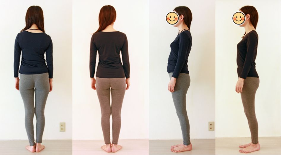 �y���@�ړI�z�ۂ����肨���A���E���̘c�݁A������A��̑傫���Ƙc��